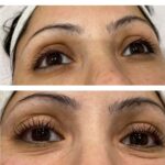 eyelash treatment before and after